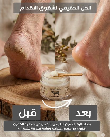 مرطب الشحوم البقرية العميق
